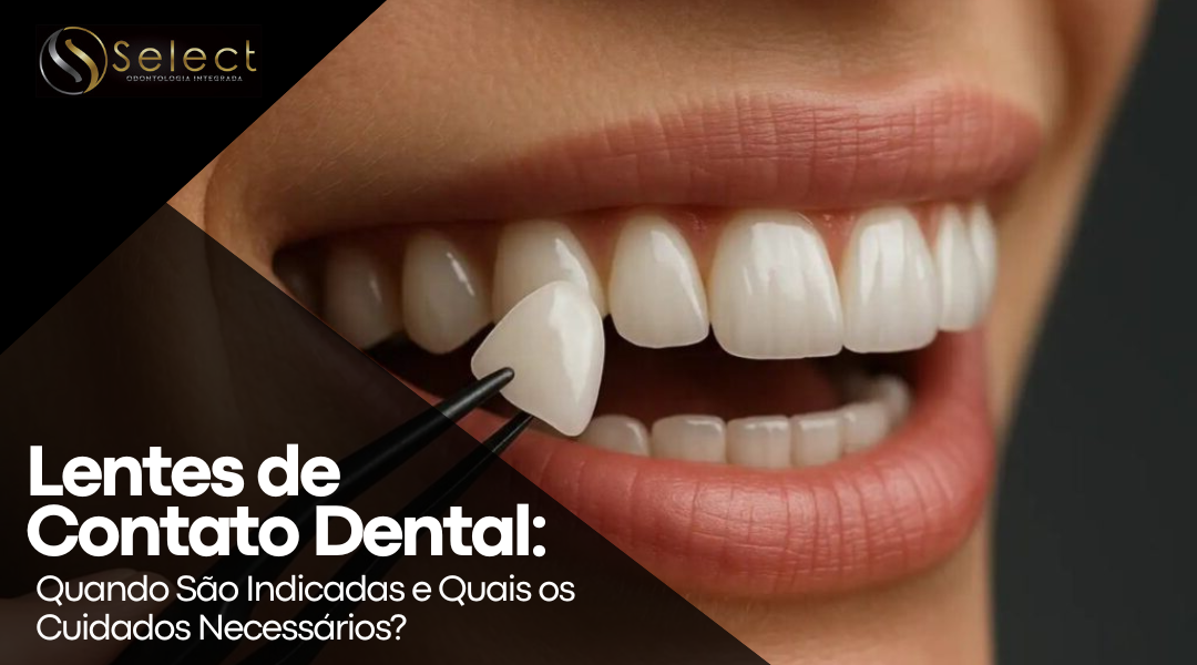 Lentes de Contato Dental: Quando São Indicadas e Quais os Cuidados Necessários?