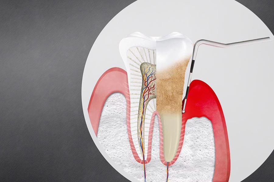 Select Odontologia Integrada - clínica odontológica em Copacabana - Periodontia