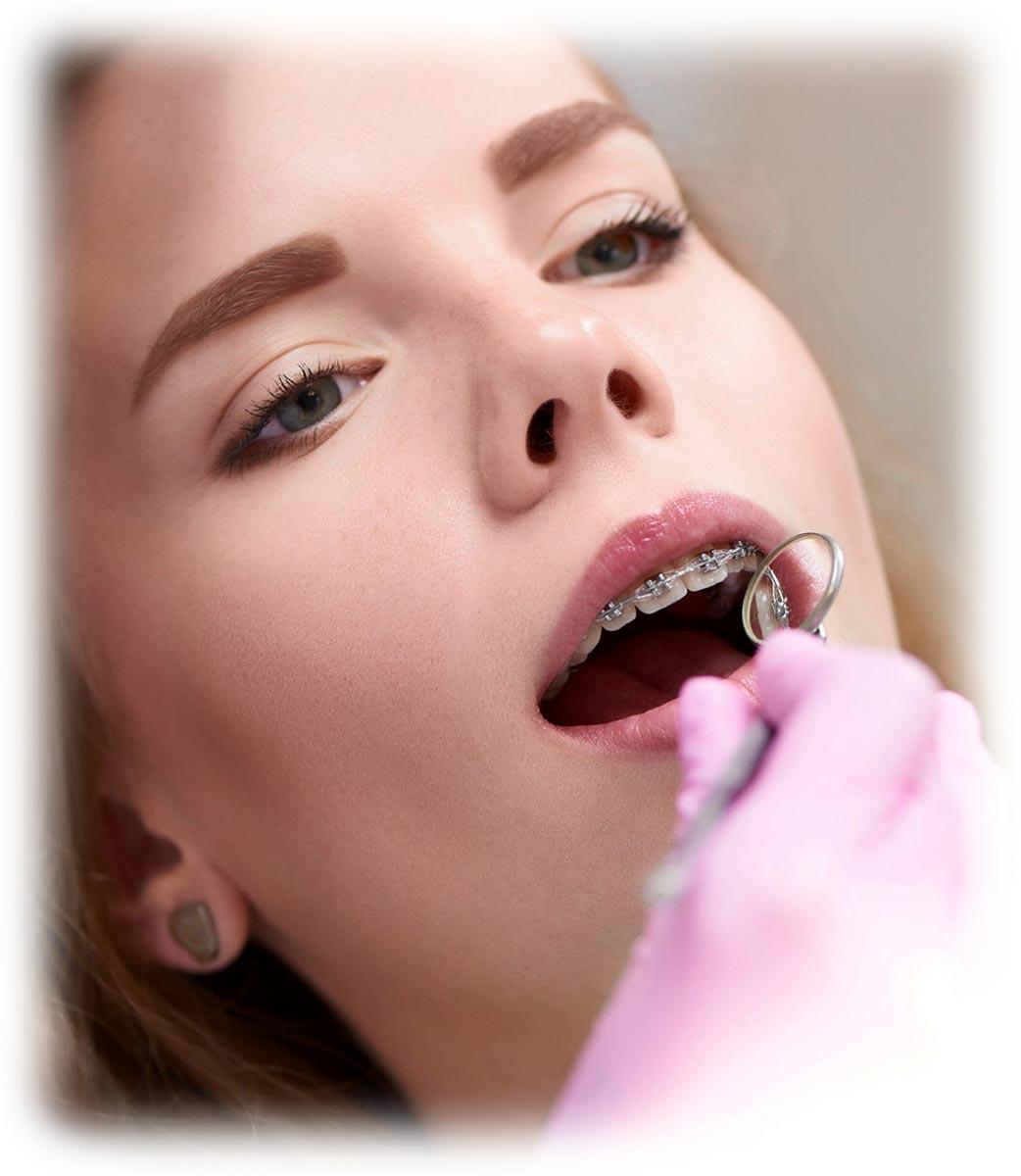 Ortodontia - Aparelho Ortodôntico em Copacabana. Ajuste do aparelho